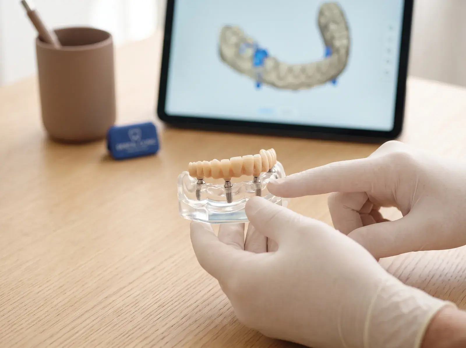 Gloved hands holding a full-arch treatment planning model, with a digital scan of the same arch on a screen behind